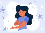 illustration eczéma